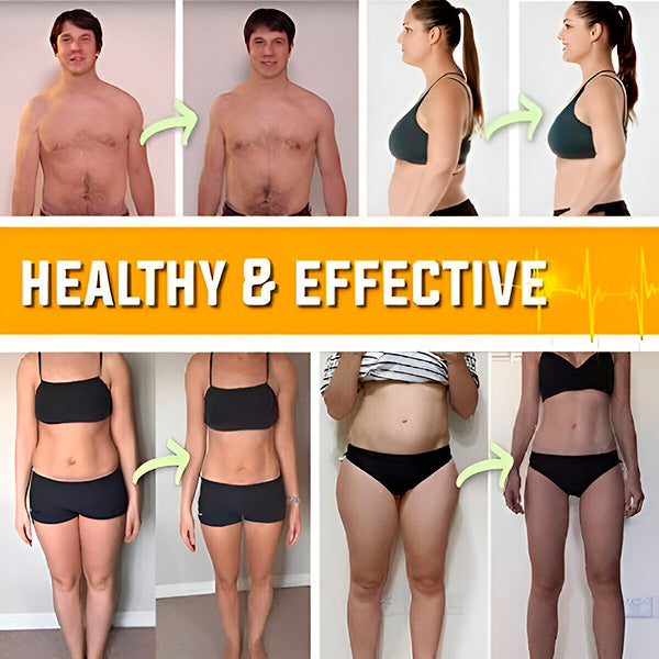 Pojas za mršavljenje i smanjenje celulita | SHAPEUP